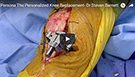 steven-barnett-surgery-procedural-videos
